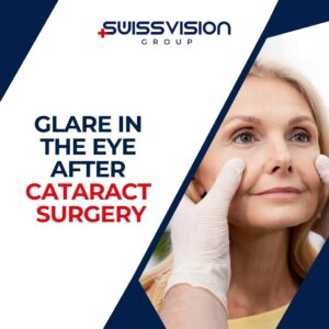 Glare in the eye after cataract surgery