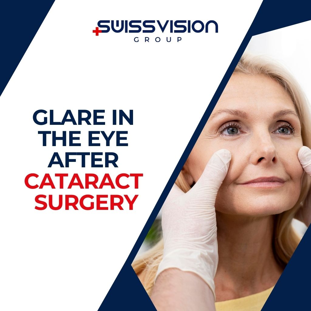 Glare in the eye after cataract surgery