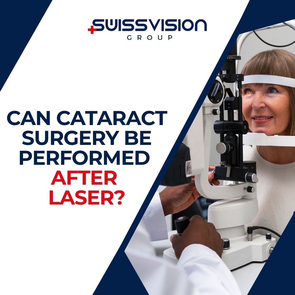 Can Cataract Surgery Be Performed After Laser