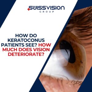 How Do Keratoconus Patients See How Much Does Vision Deteriorate