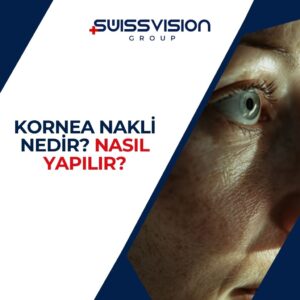 Kornea Nakli Nedir Nasıl Yapılır