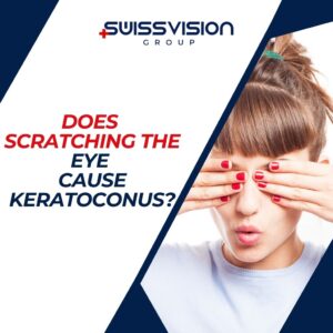 Does Scratching the Eye Cause Keratoconus