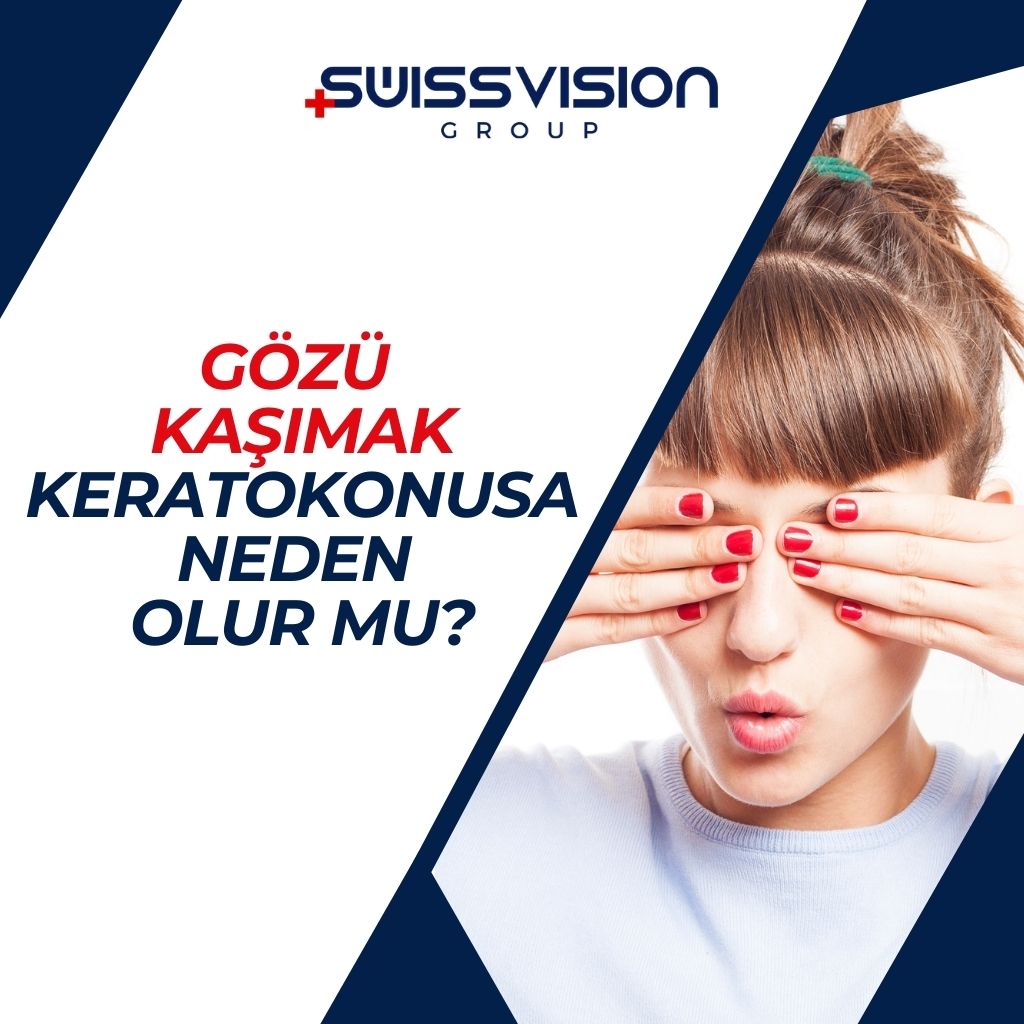 Gozu Kasimak Keratokonusa Neden Olur mu