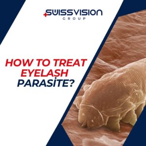 How to Treat Eyelash Parasite