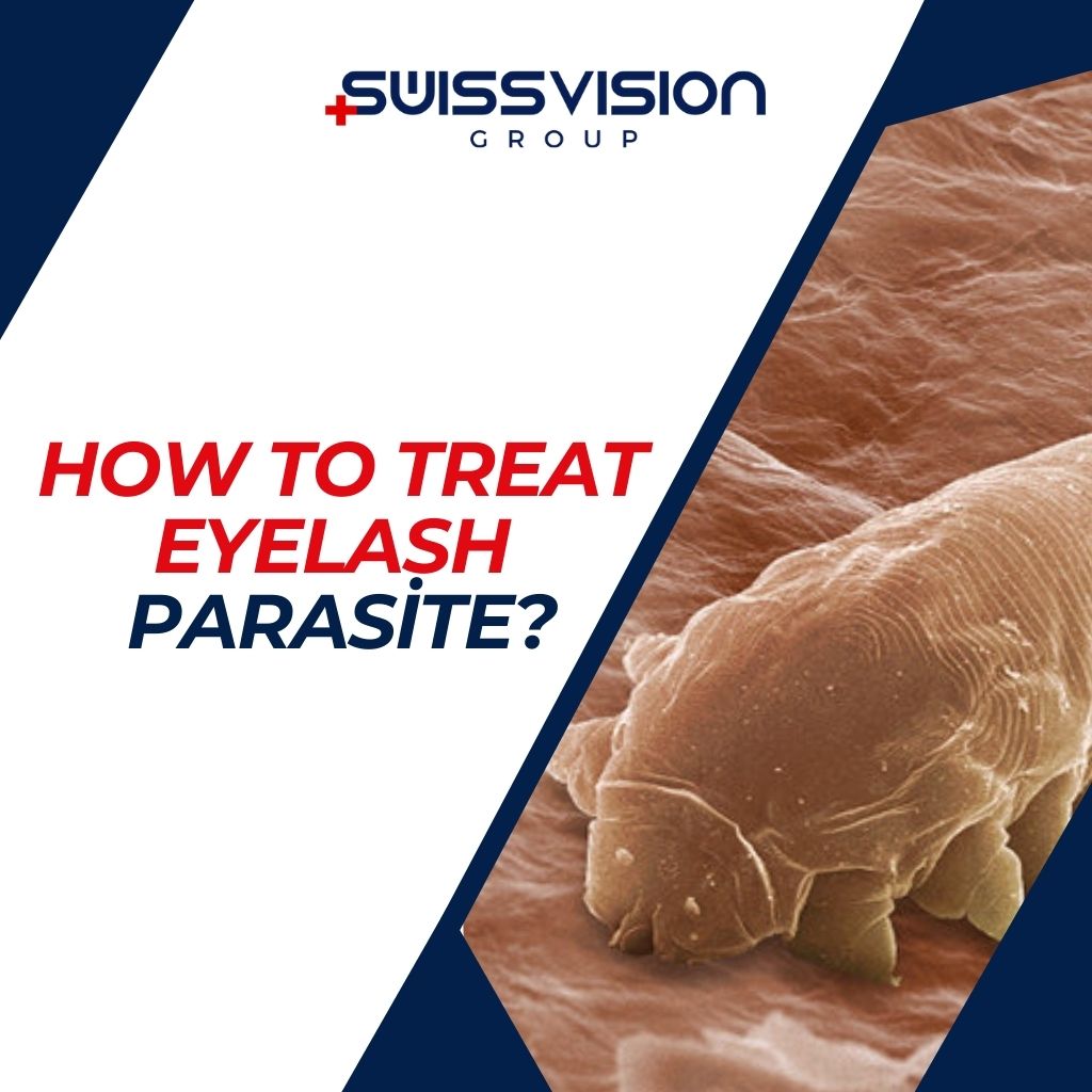 How to Treat Eyelash Parasite