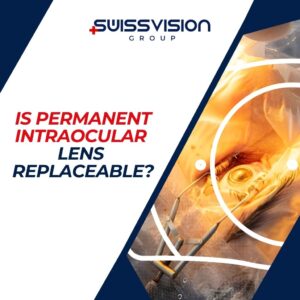 Is Permanent Intraocular Lens Replaceable