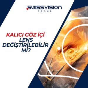 Kalıcı Göz içi Lens Değiştirilebilir mi