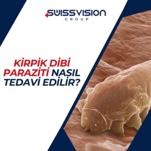 Kirpik Dibi Paraziti Nasıl Tedavi Edilir