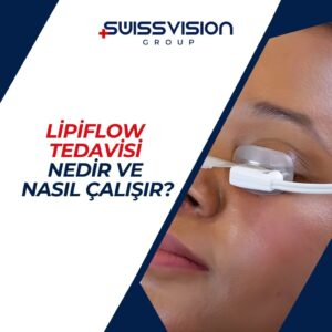 Lipiflow Tedavisi Nedir ve Nasıl Çalışır