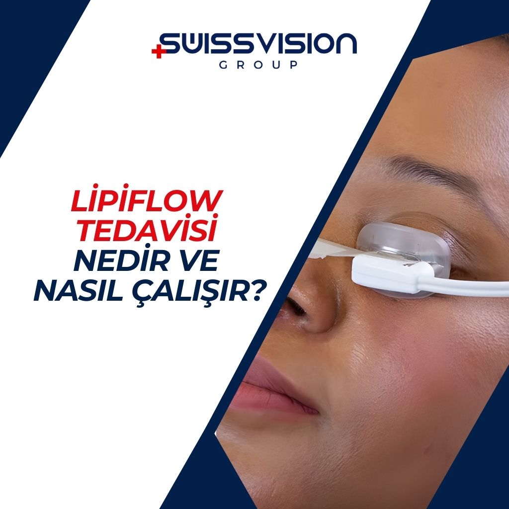 Lipiflow Tedavisi Nedir ve Nasıl Çalışır