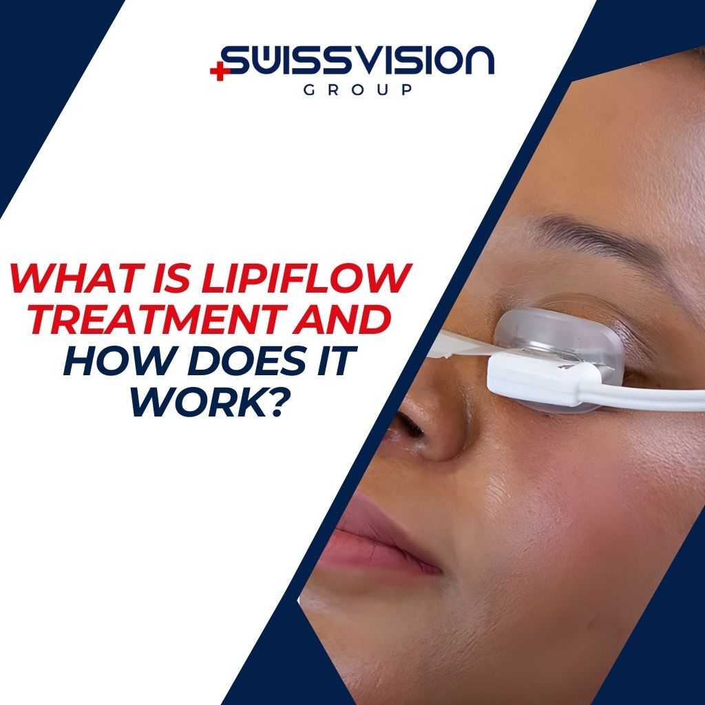 What is Lipiflow Treatment and How Does It Work