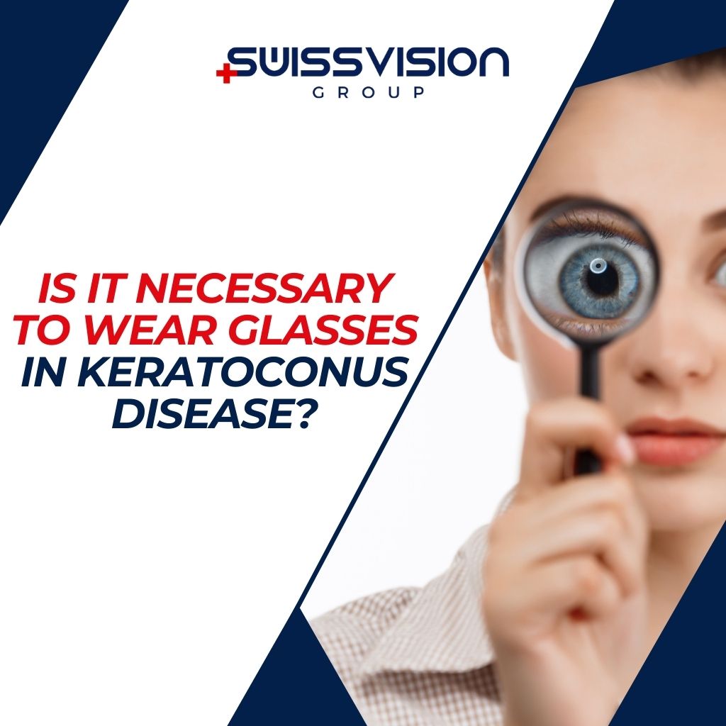 Is It Necessary to Wear Glasses in Keratoconus Disease