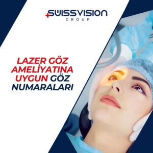 Lazer Göz Ameliyatına Uygun Göz Numaraları