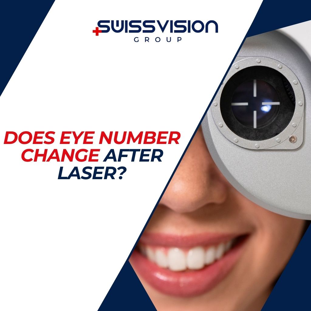 Does Eye Number Change After Laser